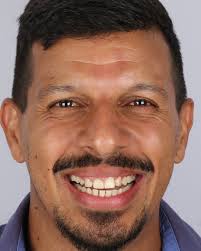 Eder Avila I DENTISTA (@drederavila) • Instagram photos and videos