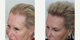 Benjamin C. Paul, MD, Board Certified Facial Plastic Surgeon