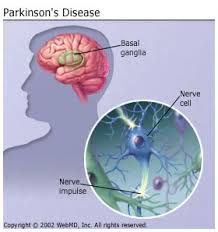 Parkinson S Disease Parkinsonism Causes Age And More