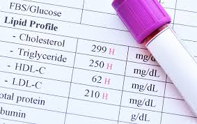 What Your Lab Results Actually Mean — And Why No One Explained Them to You