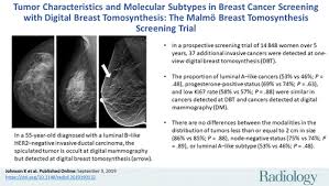 Read about the mammogram screening procedure for breast cancer prevention. Tumor Characteristics And Molecular Subtypes In Breast Cancer Screening With Digital Breast Tomosynthesis The Malmo Breast Tomosynthesis Screening Trial Radiology