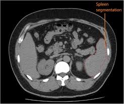 This article will focus on the superficial group. 3d Printed Ct Based Abdominal Structure Mannequin For Enabling Research 3d Printing In Medicine Full Text