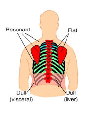 Stomach, the principal digestive organ, helps in the physical as well as chemical digestion of the food components. Percussion