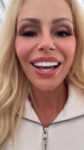 I went to Montoya in Columbia back in 2021 and all of the back composites  have broken and fallen out. I'm looking to have them redone this time with  porcelain. I am