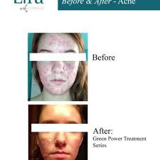 SHARON PAPADOPOULOS AESTHETICIAN