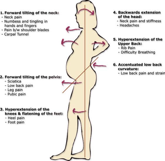 Anatomical changes and postural shifts during pregnancy, AI generated