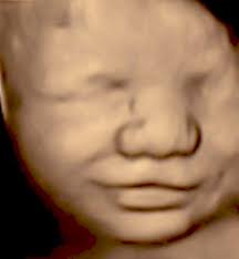 Ultrasound Images & Videos