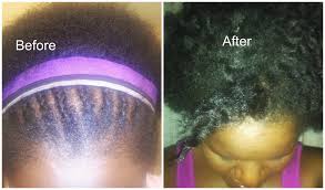 Jamaican Black Castor Oil Challenge Growing 4 Inches Of Hair In 6 Months Chic From Hair 2 Toe In 2020 Castor Oil For Hair Growth Castor Oil For Hair Hair Growth Oil