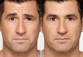 Plastic surgery might not only help make people look younger or more attractive. Male Plastic Surgery In Orange County Finesse Plastic Surgery