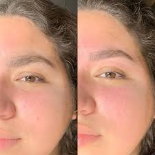 Una mirada más armoniosa, limpia y definida, respetando siempre la forma  natural del rostro 🤍 Cada diseño que realizo es 100% personalizado,  pensado para resaltar tu belleza sin exagerar. Hace cuánto no