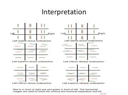 Diplopia Charting