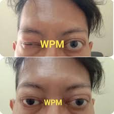 Kaya akan antioksidan yang diperoleh dari vitamin e dan vitamin c sebagai anti penuaan kulit. Wijaya Protesa Mata Jl Amalia No 6 Rt 4 Rw 3 Kota Jakarta Selatan 2021