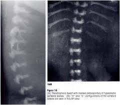 Well you're in luck, because here they come. Https Pubs Rsna Org Doi Pdf 10 1148 Radiographics 8 3 3380991