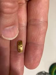 Showing 15 of 39 products. This 24 Karat Gold Weight Was Implanted In My Eyelid For 22 Years Since I Had Brain Surgery I Had It Taken Out This Week Mildlyinteresting