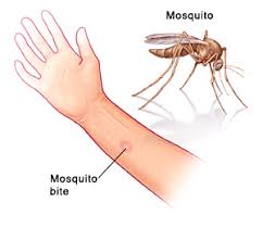 Image result for mosquito bite