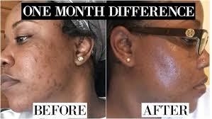 The Skin Care Routine That Changed My Life