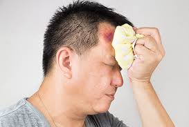 Check spelling or type a new query. Heal Bruises Home Remedies And Self Care Emedihealth