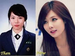 Kim Hyuna Plastic Surgery Before And After Photos Plastic Surgery Korean Celebrities Celebrities