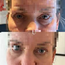 💫 Skönhetsideal förändras