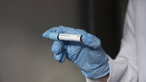 Philippines Testing Saliva Easier To Detect Covid 19
