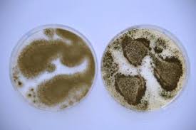 Oryzae (ahlb.) kurtzman & al. Aspergillus Oryzae Flavus Image Eurekalert Science News