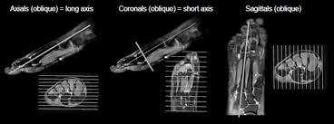 A magnetic resonance imaging (mri) was performed on a normal subject; Ankle Foot Mri