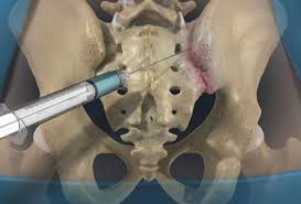 Image result for Joint Injection