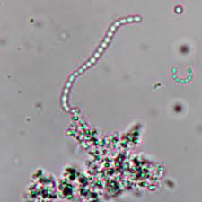 Check spelling or type a new query. Observing Bacteria Under The Light Microscope Microbehunter Microscopy