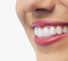 Find retainers for teeth on theanswerhub.com. Clearcorrect Bayside Family Dentistry