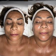 Caroline Stein Beauty In Del Mar CA