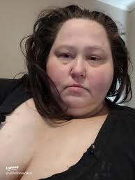 Ozempic Face Before and After: Real Changes and How to Manage Them