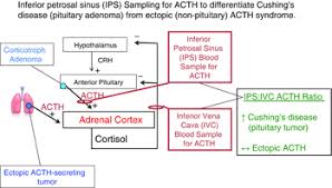 Cushing S Syndrome From Physiological Principles To Diagnosis And Clinical Care Raff 2015 The Journal Of Physiology Wiley Online Library