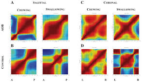 Its quite easy to change between constant and motion. Craniofacial Tongue And Speech Characteristics In Anterior Open Bite Patients Of East African Ethnicity