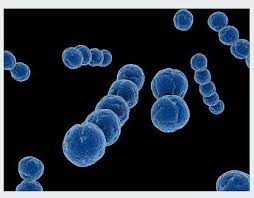 Image result for Group D Streptococcus