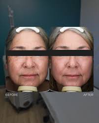 CAPS Plastic Surgery, Dermatology, MedSpa, & Wellness Center added a new... 