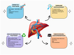 Infographic on autoimmune liver disease: liver illustration with genetic, immune, environmental, and individual risk factors