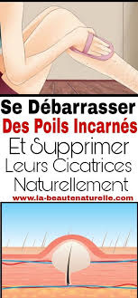 Astuce Epilation En 2020 Poil Incarne Cicatrice Poil Sous Peau