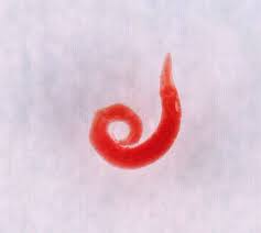 Image result for Pinworm