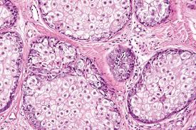 Image result for Sebaceous Gland