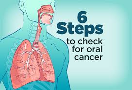 The sensation of a lump in the throat is called globus. Self Exam To Detect Oral Cancer Cancer Care Healthy News Blog Lee Health