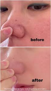 best peeling gel yang cuman 40ribuan ya g2g exfo smooth peeling gel, c...