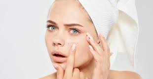 Dry and Dull Skin Artinya: Kenapa Kulit Terasa Kusam dan Kering, dan Apa  Solusinya?