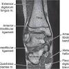 The extrinsic muscles are located in the anterior and lateral compartments of the leg. 1