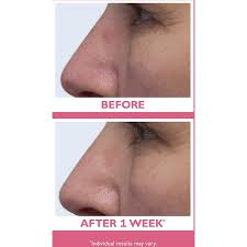 Peter thomas roth is a skincare pioneer in the beauty industry. Peter Thomas Roth Vital E Microbiome Moisture Defense Cream Ulta Beauty