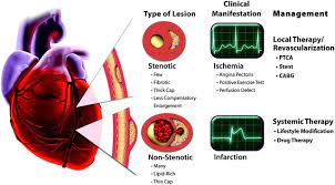 The Vascular Biology Of Atherosclerosis And Imaging Targets Journal Of Nuclear Medicine