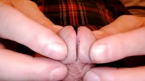 showing my new modding of my split glans