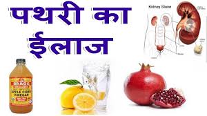 Kidney Stone Ayurvedic Treatment In Hindi Kidney Failure Disease