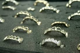 On the higher end of the price spectrum, you can even pay up to $250,000 for a set of customized diamond grillz. The Rise In Gold Prices Has Hurt The Business Of Selling Grills Oakland North