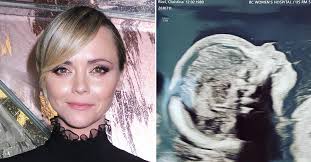 Christina ricci plastic surgery 2021. Mywk T6ahn2gim