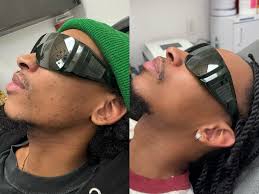 L.A.C.I. (@laser_aesthetics_institute) · Atlanta, GA